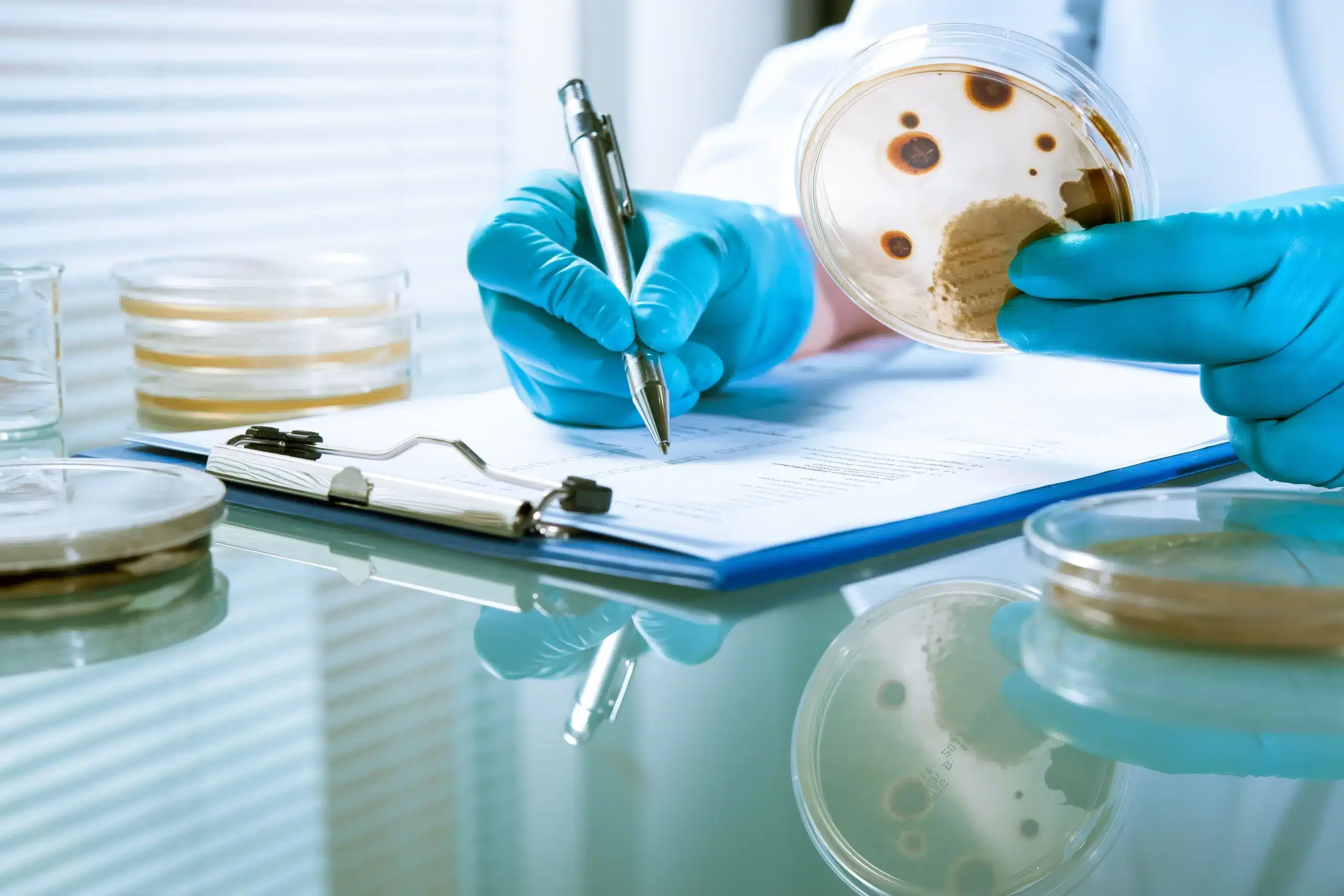 boite de pétri avec des bactéries